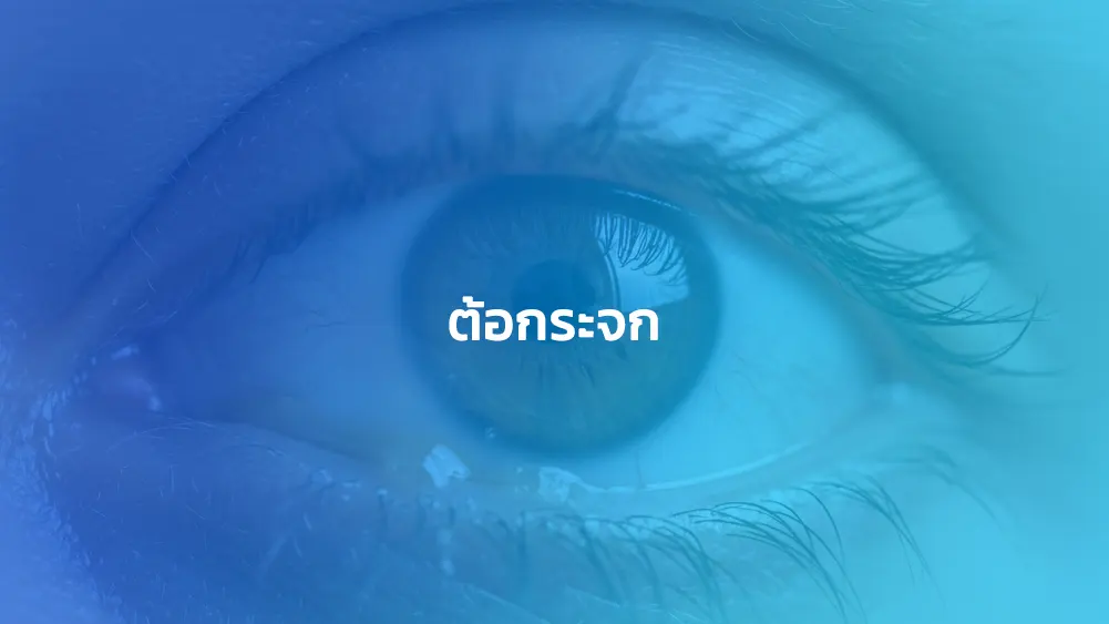 ต้อกระจก