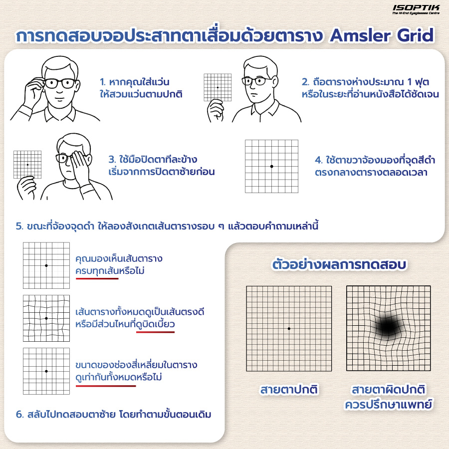 ทดสอบจอประสาทตาเสื่อมด้วยตาราง Amsler Grid