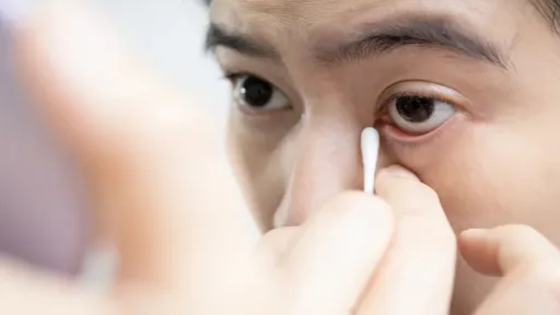 เยื่อบุตาอักเสบ ขี้ตาเยอะ