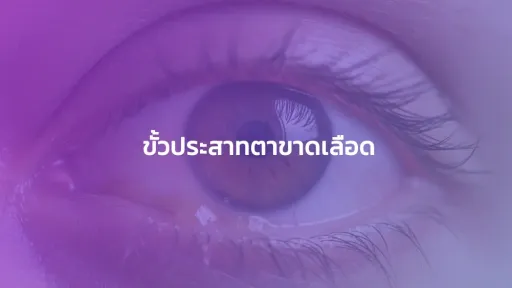  ขั้วประสาทตาขาดเลือด