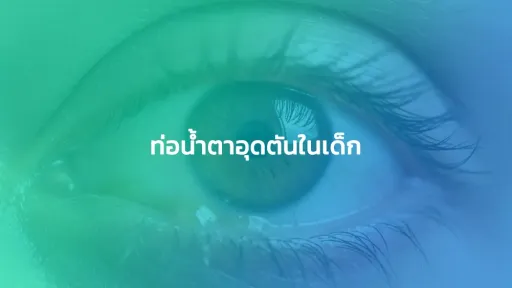 ท่อน้ำตาอุดตันในเด็ก