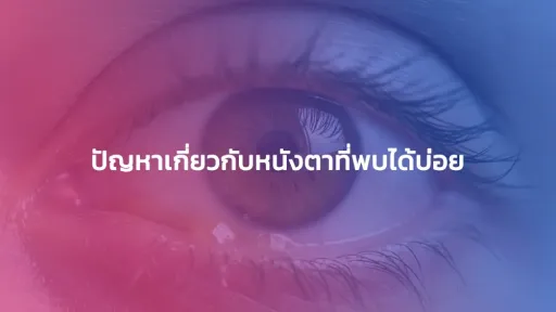 ปัญหาเกี่ยวกับหนังตาที่พบได้บ่อย