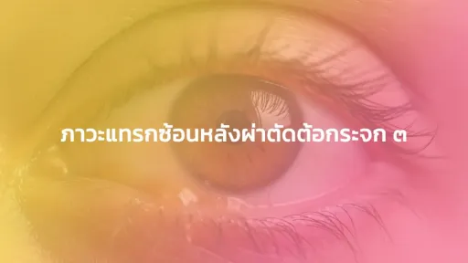 ภาวะแทรกซ้อนหลังผ่าตัดต้อกระจก 3