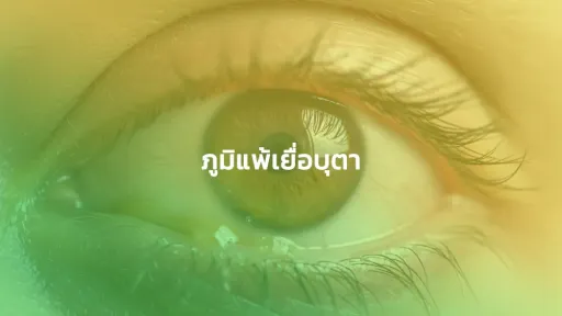 ภูมิแพ้เยื่อบุตา