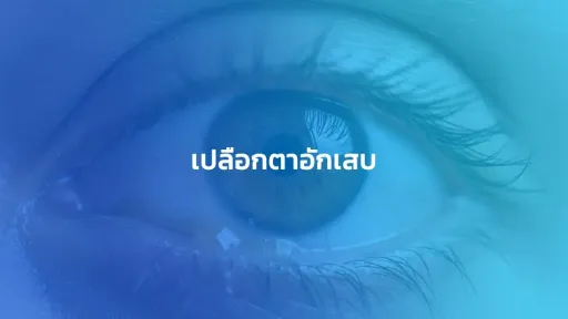 เปลือกตาอักเสบ