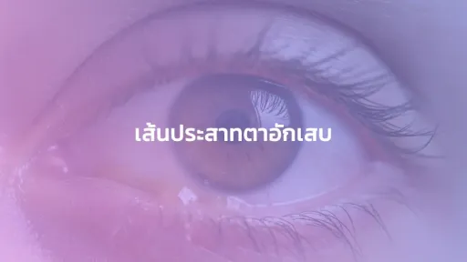 เส้นประสาทตาอักเสบ