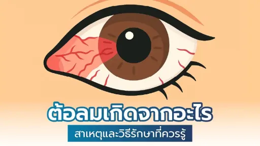ต้อลมเกิดจากอะไร รวมสาเหตุและวิธีรักษาที่ควรรู้