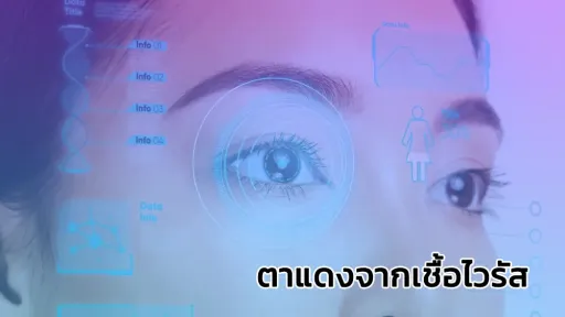 ตาแดงจากเชื้อไวรัส