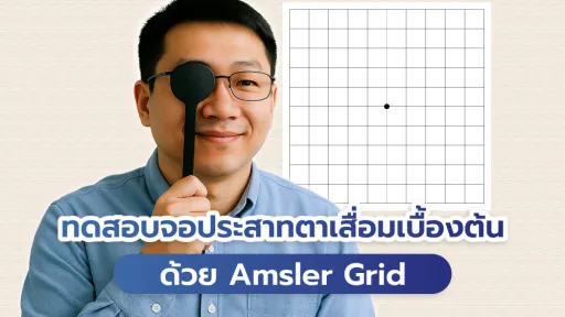  ทดสอบจอประสาทตาเสื่อมด้วยตัวเอง