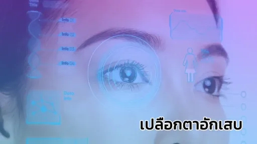 เปลือกตาอักเสบ