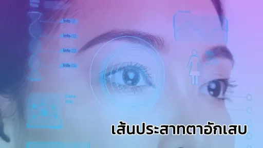 เส้นประสาทตาอักเสบ