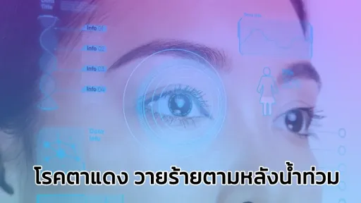 โรคตาแดง วายร้ายตามหลังน้ำท่วม