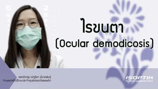 สุขภาพสายตา "ไรขนตา (Ocular demodicosis)" โดย แพทย์หญิง ณัฐธิดา นิ่มวรพันธุ์