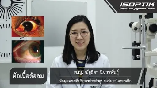 สุขภาพสายตา " ต้อเนื้อต้อลม " - โดย แพทย์หญิง ณัฐธิดา นิ่มวรพันธุ์