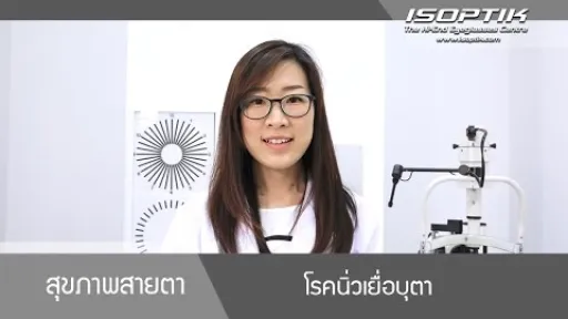 สุขภาพสายตา " นิ่วเยื่อบุตา ( Conjunctival concretion ) " - โดย แพทย์หญิง ณัฐธิดา นิ่มวรพันธุ์