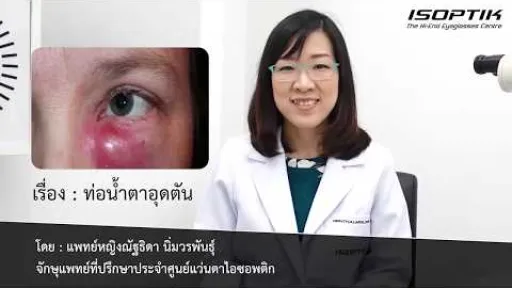 สุขภาพสายตา " ท่อน้ำตาอุดตัน " - โดย แพทย์หญิง ณัฐธิดา นิ่มวรพันธุ์