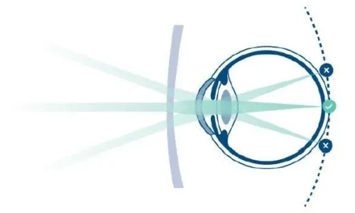 rodenstock