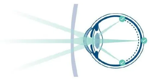 rodenstock