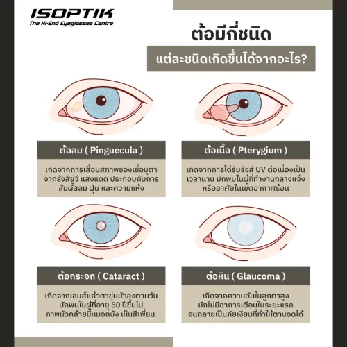 ร้านตัดแว่นโปรเกรสซีฟ