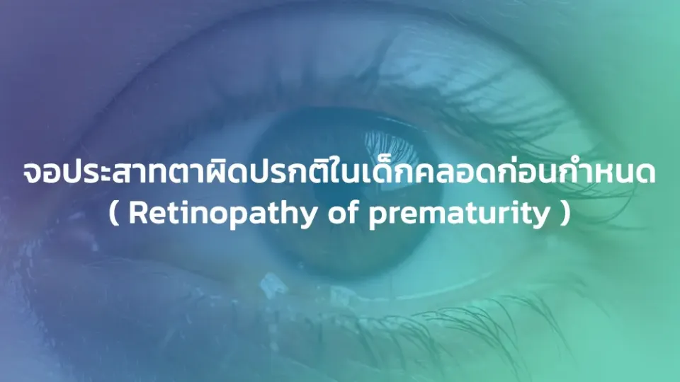 จอประสาทตาผิดปรกติในเด็กคลอดก่อนกำหนด ( Retinopathy of prematurity )