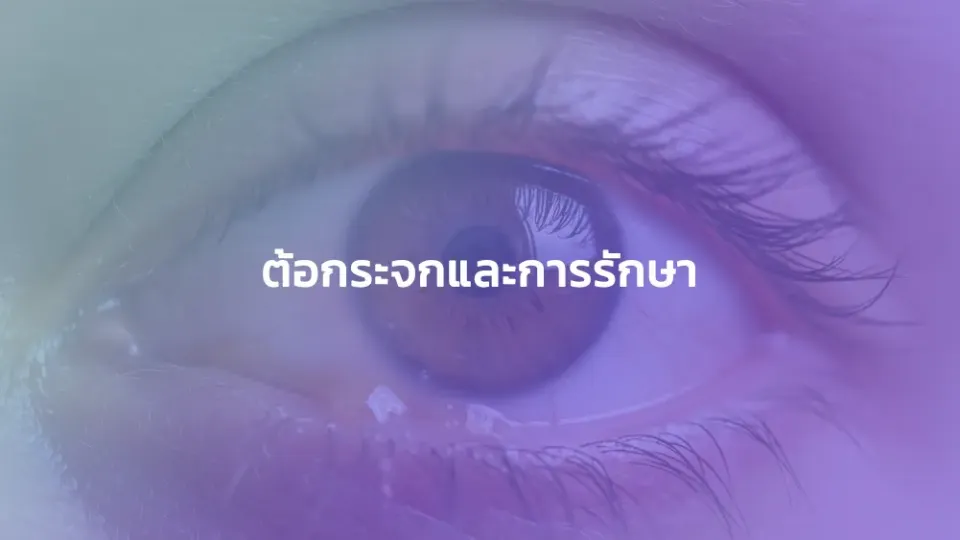 ต้อกระจกและการรักษา