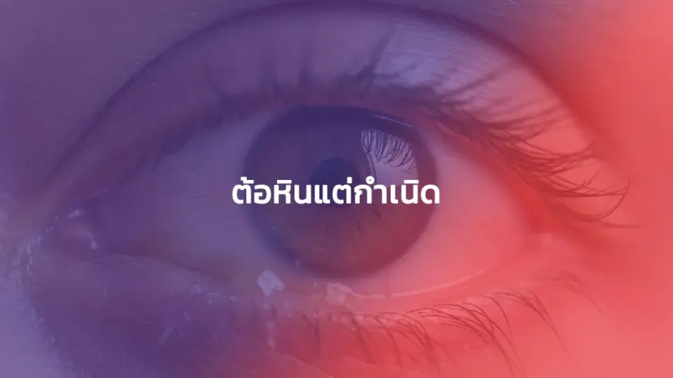 ต้อหินแต่กำเนิด