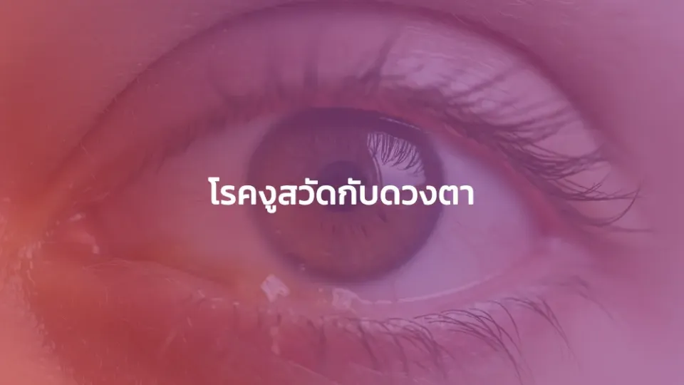 โรคงูสวัดกับดวงตา