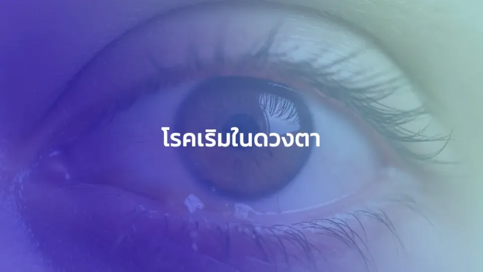 โรคเริมในดวงตา