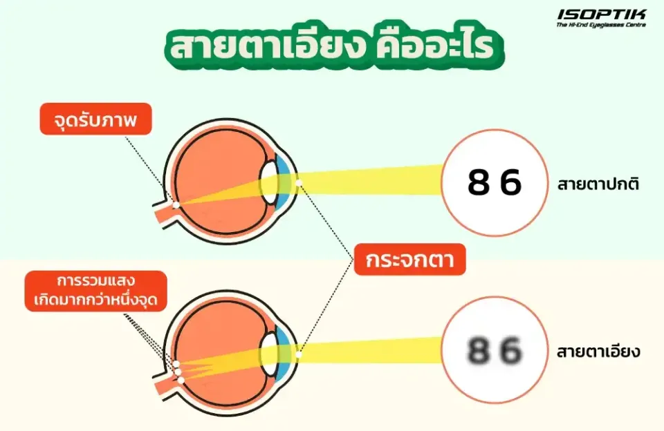สายตาเอียง ( Astigmatism ) คืออะไร