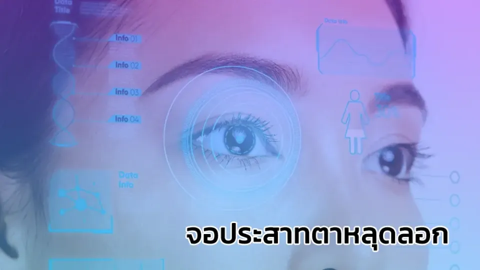 จอประสาทตาหลุดลอก