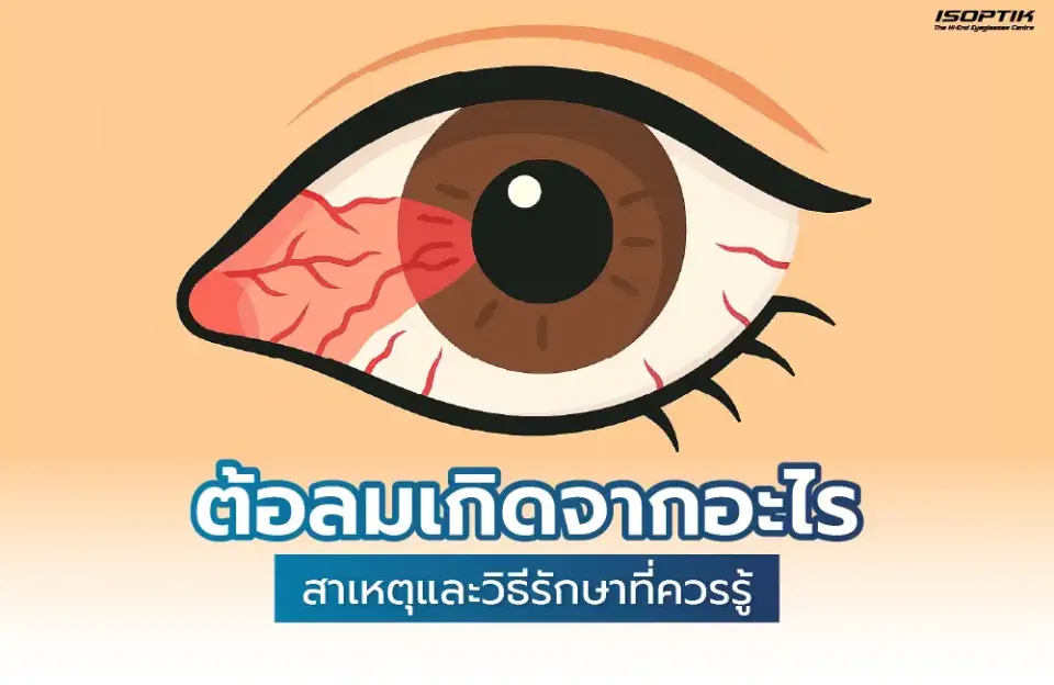 ต้อลมเกิดจากอะไร รวมสาเหตุและวิธีรักษาที่ควรรู้