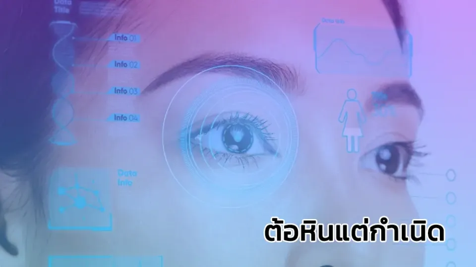 ต้อหินแต่กำเนิด