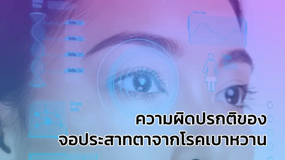ความผิดปรกติของจอประสาทตาจากโรคเบาหวาน