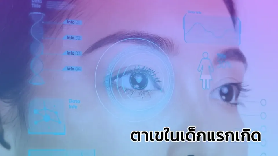 ตาเขในเด็กแรกเกิด