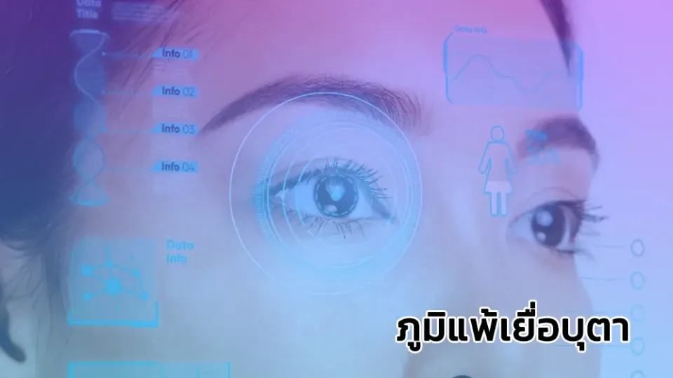 ภูมิแพ้เยื่อบุตา