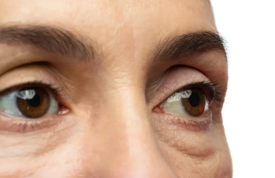 จอประสาทตาเสื่อม อาการเริ่มต้นเป็นอย่างไร