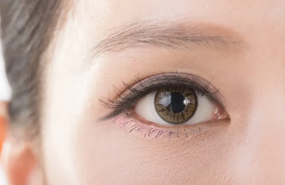 ตาบอดสี คืออะไร รักษาหายได้ไหม