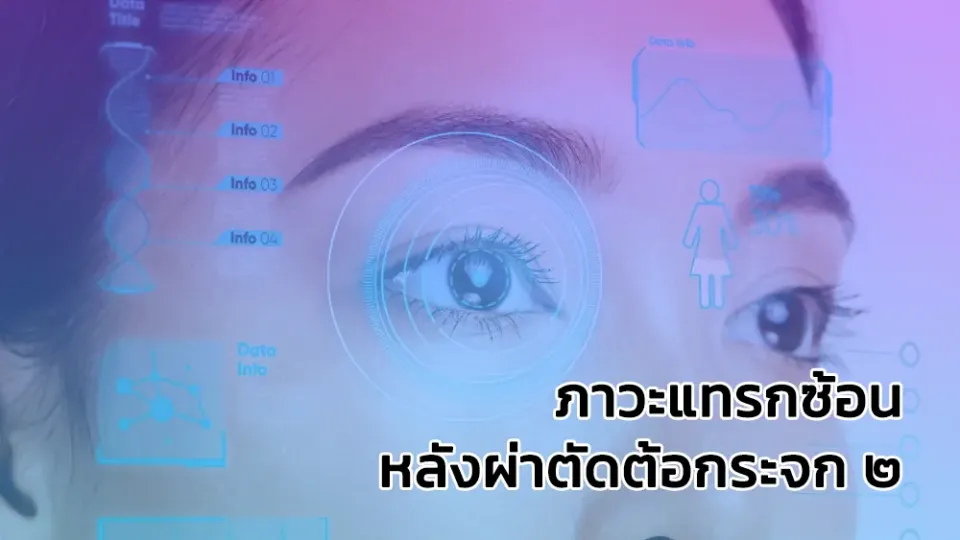 ภาวะแทรกซ้อนหลังผ่าตัดต้อกระจก 2