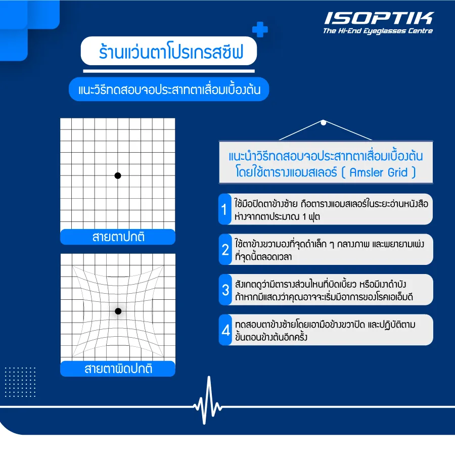 ร้านแว่นตาโปรเกรสซีฟ ISOPTIK ชี้สัญญาณเตือน ! โรคจอประสามตาเสื่อม
