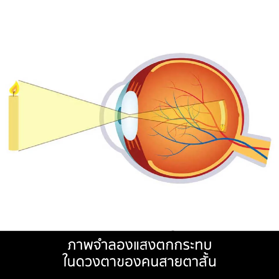 คนสายตา สั้น ยาว เอียง มองเห็นภาพแบบไหนกันบ้าง
