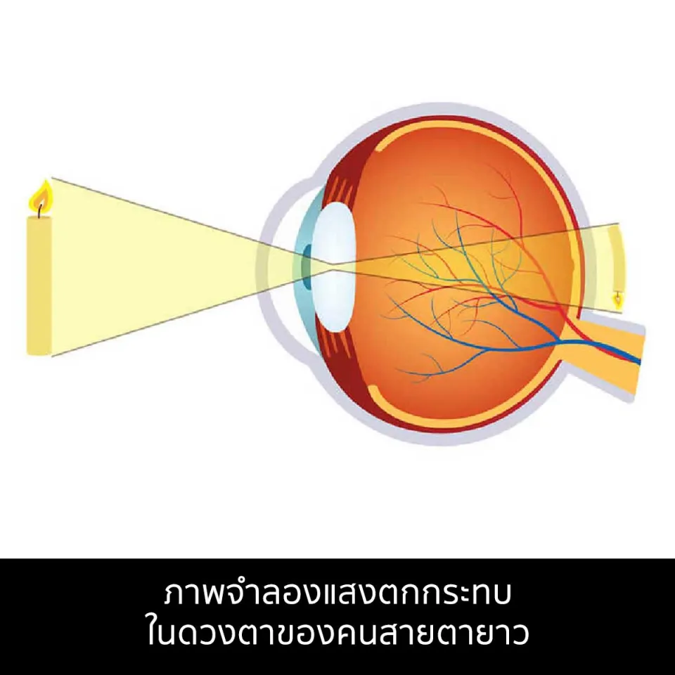คนสายตา สั้น ยาว เอียง มองเห็นภาพแบบไหนกันบ้าง